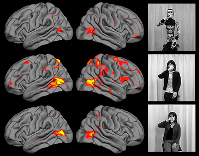 Brain activity images